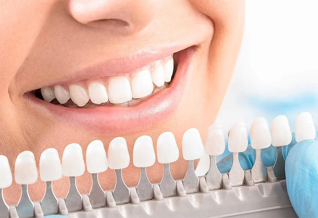 How to prevent tooth enamel loss or damage